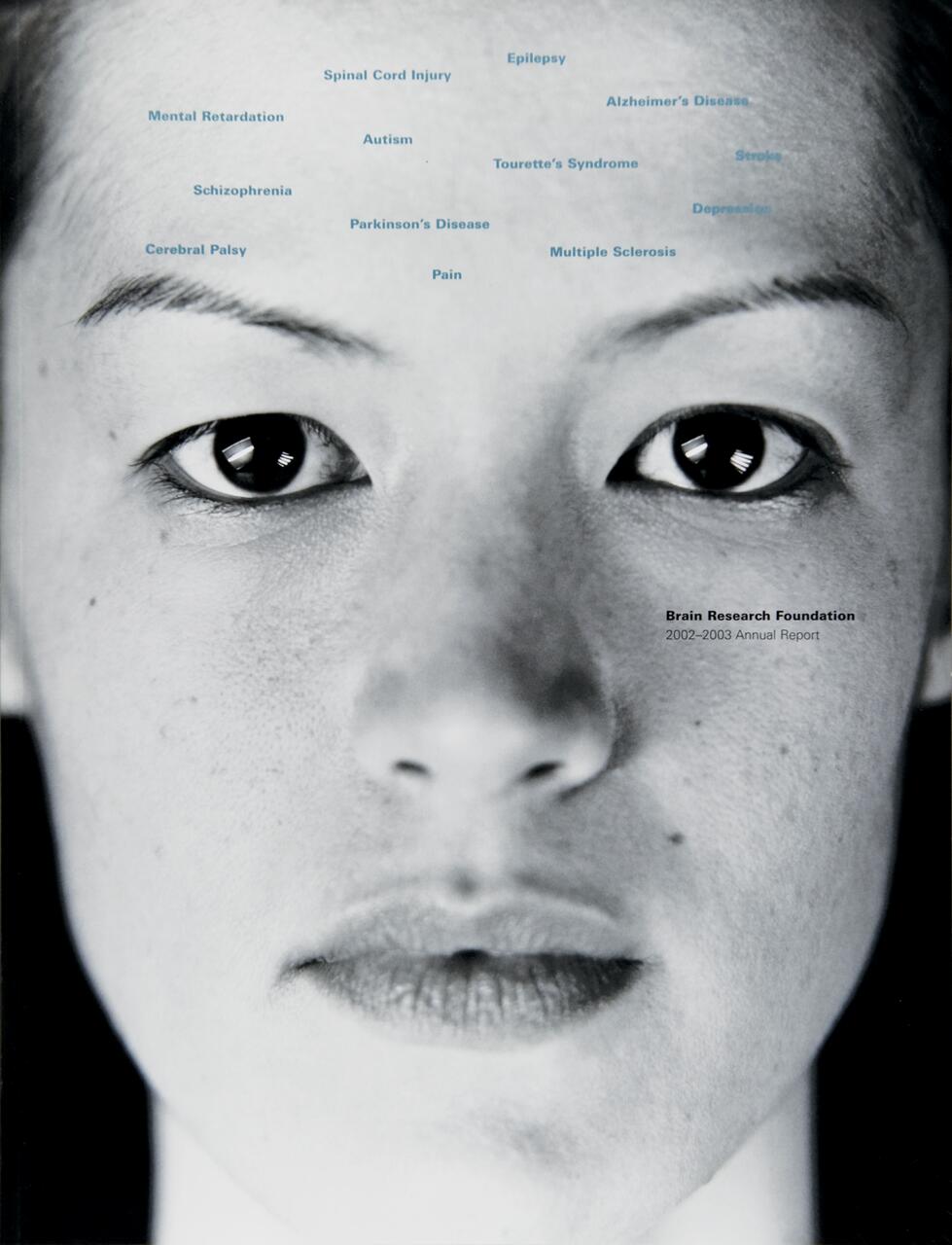 Close-up of a person's face in black and white with various neurological and psychological conditions written on the forehead, including epilepsy, autism, and Alzheimer's disease. The image features a serious expression.