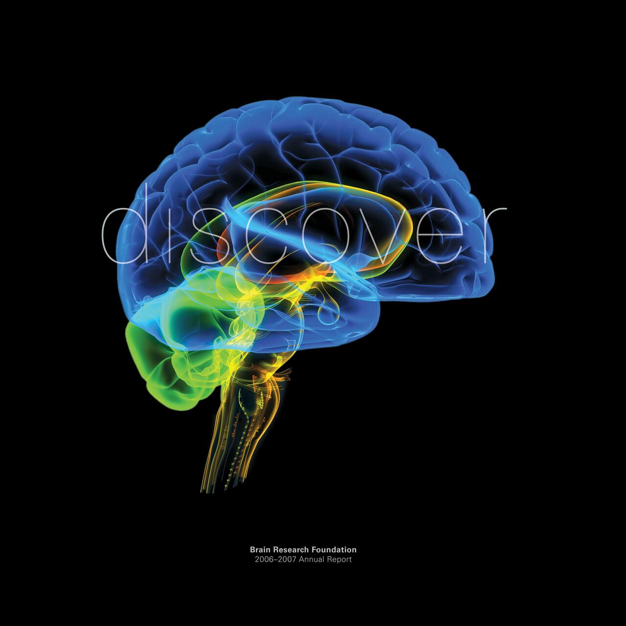 Colorful X-ray illustration of a human brain on a black background, highlighting neural pathways in blue, green, and yellow.