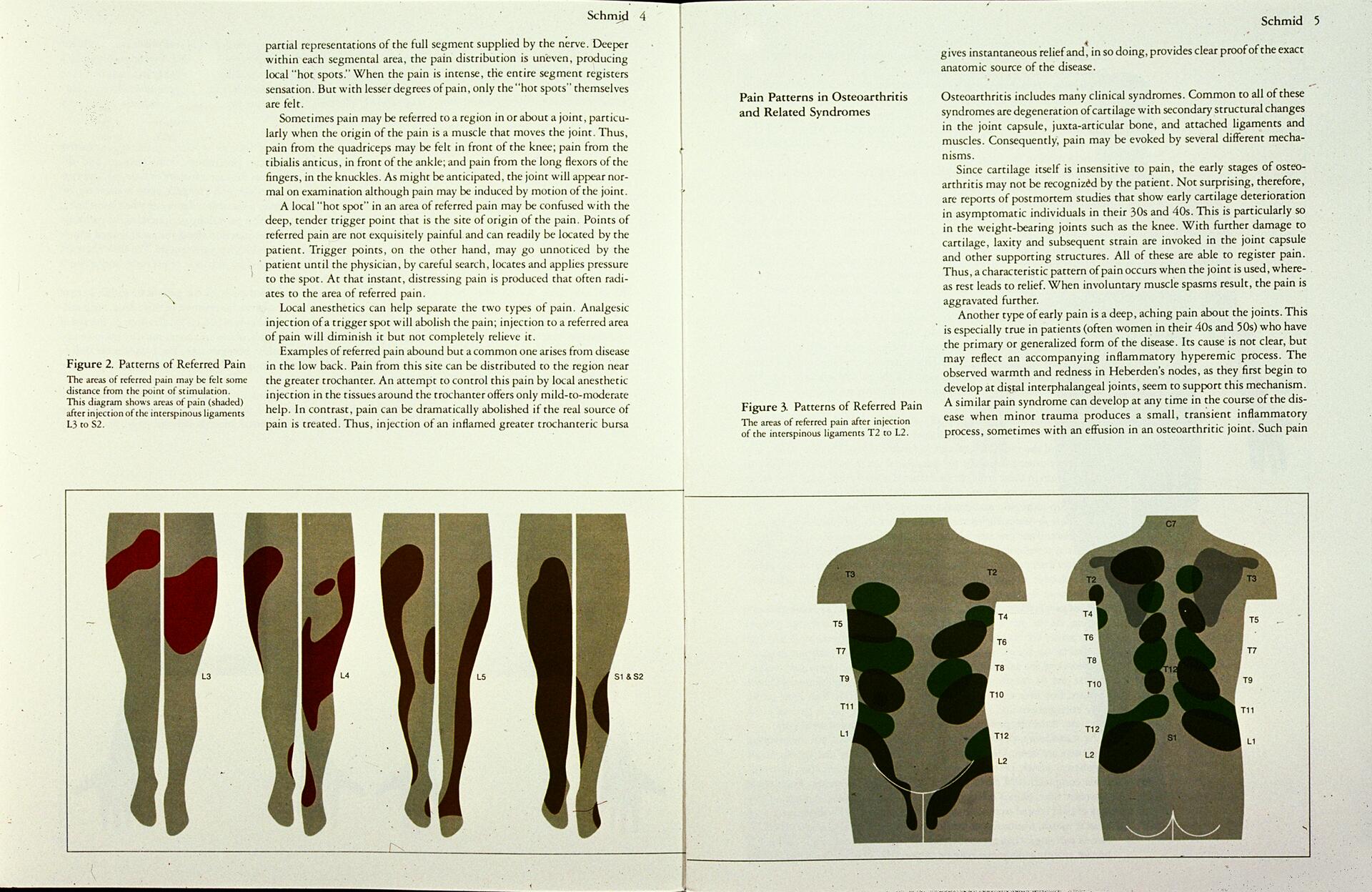 Diagrams showing patterns of referred pain for Figures 2 and 3. Figure 2 highlights areas on the back and sides of legs with shaded regions in red and brown, labeled L3-S2. Figure 3 shows a torso with green shaded areas labeled T2-S1, on both front and back views.